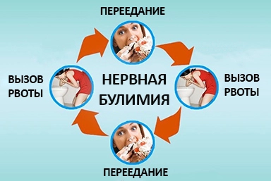 Лечение булимии в Чебаркуле